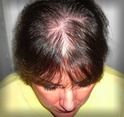 signs of thyroid problems