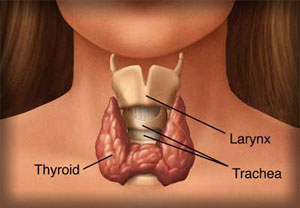 thyroid causes