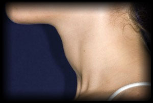thyroid symptoms